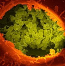 Q © National Institutes of Health (NIH)